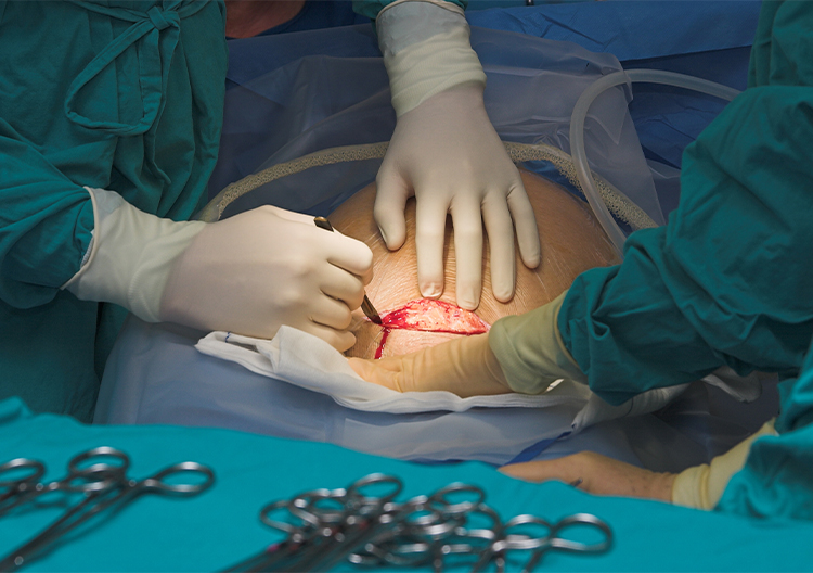 Consult Dr. Harshrika Holkar for the best Caesarean Section Delivery services in Thane, Mumbai, ensuring safe and expert care for mothers and babies.