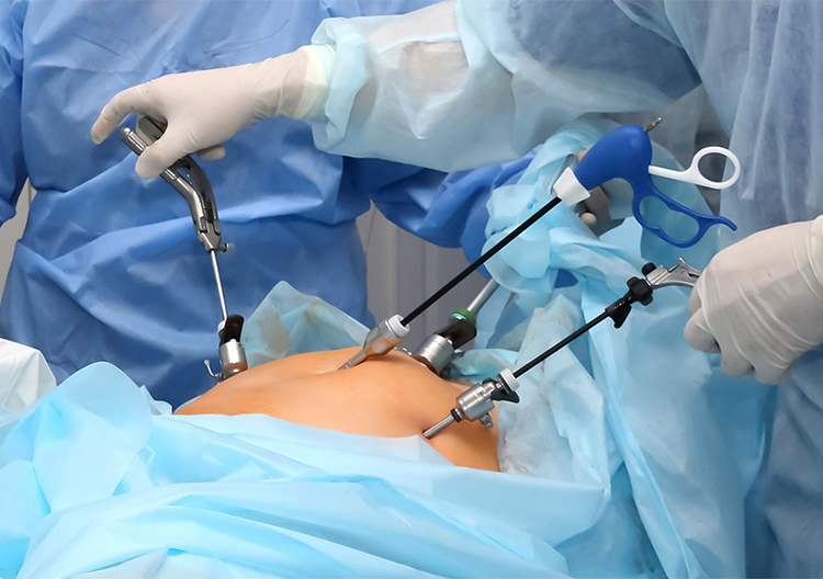 Frequently Asked Questions on Operative Technique of Laparoscopic